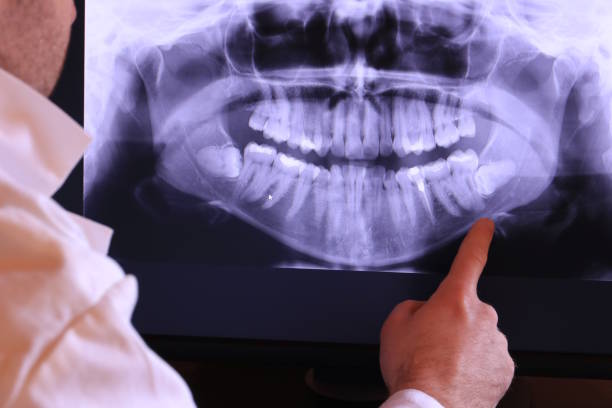 Best Tooth Infection Emergency Dentist  in Manchester, MD